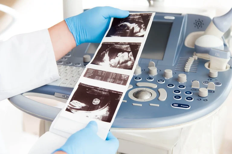 Usg w ciąży Rzeszów co pacjentki powinny wiedzieć o leczeniu oraz jak się do niego przygotować?